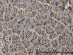 Novus Biologicals ELA3A Antibody (3G4), Novus Biologicals 0.1 mg | Buy Online | Novus Biologicals&trade; | Fisher Scientific