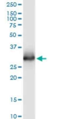 Novus Biologicals ELA3A Antibody (3G4), Novus Biologicals 0.1 mg | Buy Online | Novus Biologicals&trade; | Fisher Scientific