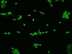 ELAC2 Antibody, Novus Biologicals 50 &mu;g, Unconjugated:Antibodies, Polyclonal