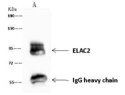 ELAC2 Antibody, Novus Biologicals 50 &mu;g, Unconjugated:Antibodies, Polyclonal