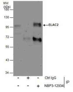 ELAC2 Antibody, Novus Biologicals 100 &mu;g | Buy Online | Novus Biologicals | Fisher Scientific