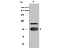 ELAC2 Antibody, Novus Biologicals 50 &mu;g, Unconjugated:Antibodies, Polyclonal