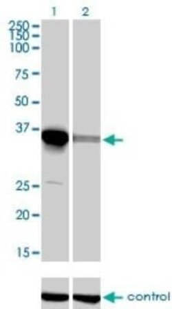 ELAVL4 Antibody (6B9), Novus Biologicals 0.1 mg | Buy Online | Novus Biologicals | Fisher Scientific