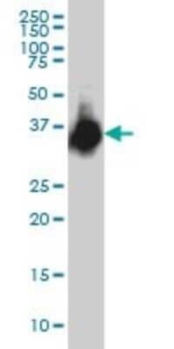 ELAVL4 Antibody (6B9), Novus Biologicals 0.1 mg | Buy Online | Novus Biologicals | Fisher Scientific