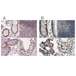 ELF2 Antibody, Novus Biologicals:Antibodies:Primary Antibodies