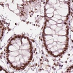 ELF2 Antibody, Novus Biologicals:Antibodies:Primary Antibodies