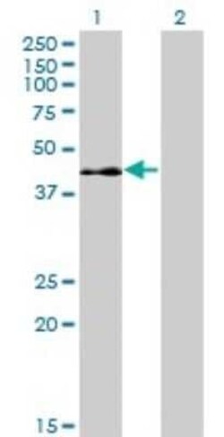 ELK3 Antibody (3A12), Novus Biologicals 0.1 mg | Buy Online | Novus Biologicals | Fisher Scientific