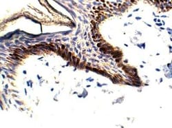ELOVL1 Antibody, Novus Biologicals 100 &mu;g; Unconjugated:Antibodies,
