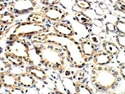 ELOVL1 Antibody, Novus Biologicals 100 &mu;g; Unconjugated:Antibodies,