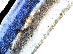 ELOVL1 Antibody, Novus Biologicals 100 &mu;g; Unconjugated:Antibodies,