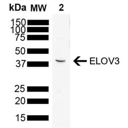 ELOVL3 Antibody (V61P2B3-D10), Novus Biologicals:Antibodies:Primary Antibodies