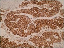 ELOVL3 Antibody (V61 P2B3 D10) - BSA Free, Novus Biologicals:Antibodies:Primary