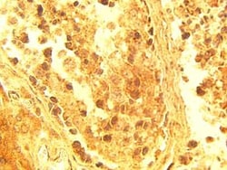 ELOVL4 Rabbit anti-Human, Polyclonal, Novus Biologicals:Antibodies:Primary