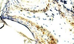 ELOVL4 Antibody, Novus Biologicals 100 &mu;g | Buy Online | Bio-Techne | Fisher Scientific