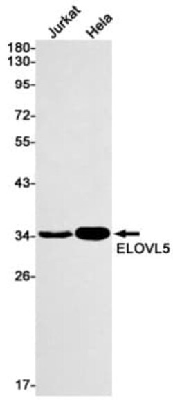 ELOVL5 Antibody (S07-7B3), Novus Biologicals 50 &mu;g; Unconjugated:Antibodies,