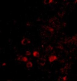 ELOVL6 Antibody - BSA Free, Novus Biologicals 0.1 mg | Buy Online | Novus Biologicals | Fisher Scientific