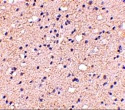 ELOVL6 Antibody - BSA Free, Novus Biologicals 0.1 mg | Buy Online | Novus Biologicals | Fisher Scientific