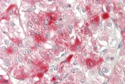 ELOVL6 Rabbit anti-Human, Polyclonal, Novus Biologicals 0.1 mL; Unconjugated:Antibodies,