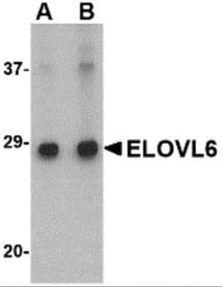ELOVL6 Antibody - BSA Free, Novus Biologicals 0.1 mg | Buy Online | Novus Biologicals | Fisher Scientific