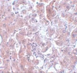 ELOVL7 Antibody - BSA Free, Novus Biologicals 0.1 mg | Buy Online | Novus Biologicals | Fisher Scientific