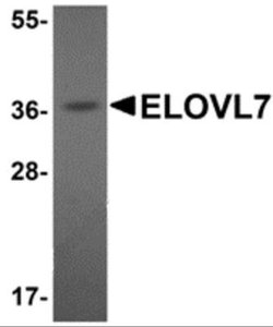 ELOVL7 Antibody - BSA Free, Novus Biologicals 0.1 mg | Buy Online | Novus Biologicals | Fisher Scientific