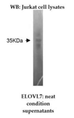 ELOVL7 Antibody (Z26) - BSA Free, Novus Biologicals:Antibodies:Primary