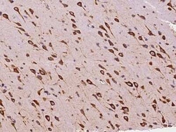 EMAP-II/AIMP1 Antibody, Novus Biologicals 50 &mu;g; Unconjugated:Antibodies,