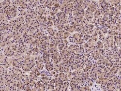 EMAP-II/AIMP1 Antibody, Novus Biologicals 50 &mu;g; Unconjugated:Antibodies,