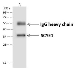 EMAP-II/AIMP1 Antibody, Novus Biologicals 50 &mu;g; Unconjugated:Antibodies,