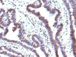 EMI1 Antibody (EMI1/1176), Novus Biologicals 0.02mg; Unlabeled:Antibodies,