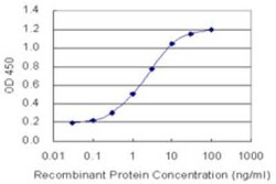 Novus Biologicals EMILIN1 Antibody (5E2), Novus Biologicals 0.1 mg | Buy Online | Novus Biologicals&trade; | Fisher Scientific