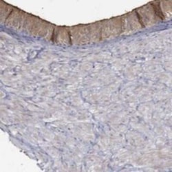 EMILIN3 Rabbit anti-Human, Polyclonal, Novus Biologicals 25 &mu;g; Unconjugated:Antibodies,