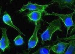 EMMPRIN/CD147 Rabbit anti-Human, Monkey, Clone: 125, Novus Biologicals:Antibodies:Primary
