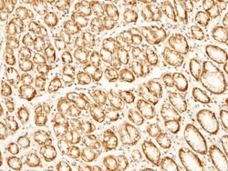 EMMPRIN/CD147 Rabbit anti-Human, Monkey, Clone: 125, Novus Biologicals:Antibodies:Primary