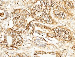 EMMPRIN/CD147 Rabbit anti-Human, Monkey, Clone: 125, Novus Biologicals:Antibodies:Primary
