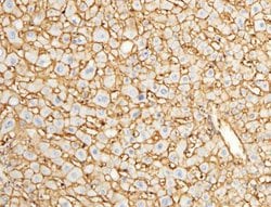 EMMPRIN/CD147 Rabbit anti-Human, Monkey, Clone: 125, Novus Biologicals:Antibodies:Primary