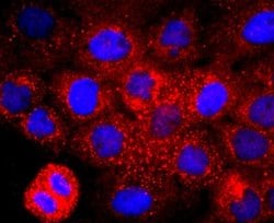 EMMPRIN/CD147 Rabbit anti-Human, Clone: JF1-045, Novus Biologicals 100&mu;L:Antibodies,