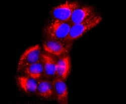 EMMPRIN/CD147 Rabbit anti-Human, Clone: JF1-045, Novus Biologicals 100&mu;L:Antibodies,