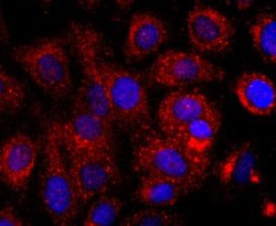 EMMPRIN/CD147 Rabbit anti-Human, Clone: JF1-045, Novus Biologicals 100&mu;L:Antibodies,