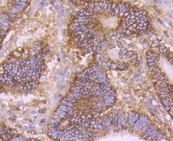 EMMPRIN/CD147 Rabbit anti-Human, Clone: JF1-045, Novus Biologicals 100&mu;L:Antibodies,