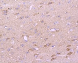 EMMPRIN/CD147 Rabbit anti-Human, Clone: JF1-045, Novus Biologicals 100&mu;L:Antibodies,