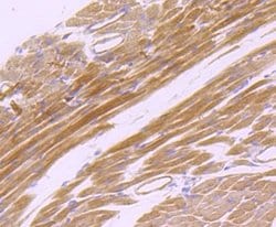 EMMPRIN/CD147 Rabbit anti-Human, Clone: JF1-045, Novus Biologicals 100&mu;L:Antibodies,