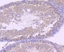 EMMPRIN/CD147 Rabbit anti-Human, Clone: JF1-045, Novus Biologicals 100&mu;L:Antibodies,