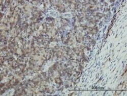 EMP3 Antibody (3D4), Novus Biologicals 0.1 mg | Buy Online | Novus Biologicals | Fisher Scientific