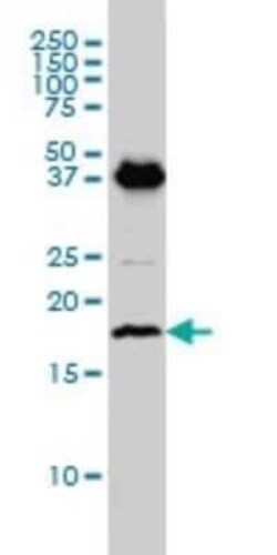 EMP3 Antibody (3D4), Novus Biologicals 0.1 mg | Buy Online | Novus Biologicals | Fisher Scientific