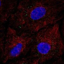 EMP3 Rabbit anti-Human, Polyclonal, Novus Biologicals 100 &mu;g; Unconjugated:Antibodies,