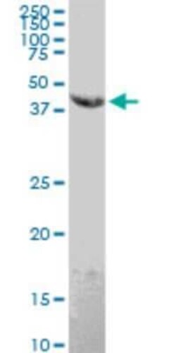 EMR4P Antibody (1G10), Novus Biologicals 0.1 mg; Unconjugated:Antibodies,