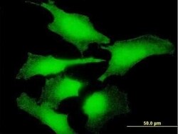ENO1P Antibody, Novus Biologicals 50 &mu;g | Buy Online | Novus Biologicals | Fisher Scientific