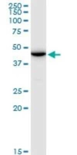 ENO1P Antibody, Novus Biologicals 50 &mu;g | Buy Online | Novus Biologicals | Fisher Scientific