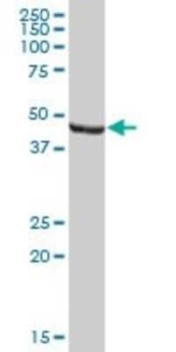 ENO1P Antibody, Novus Biologicals 50 &mu;g | Buy Online | Novus Biologicals | Fisher Scientific